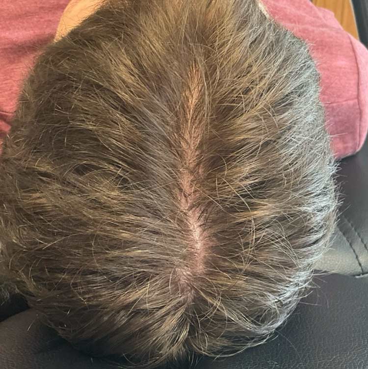 After treatment