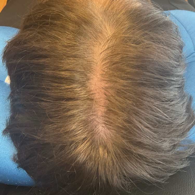Before treatment